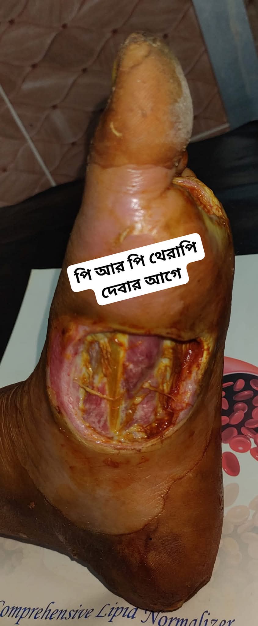 Before Skin Treatment